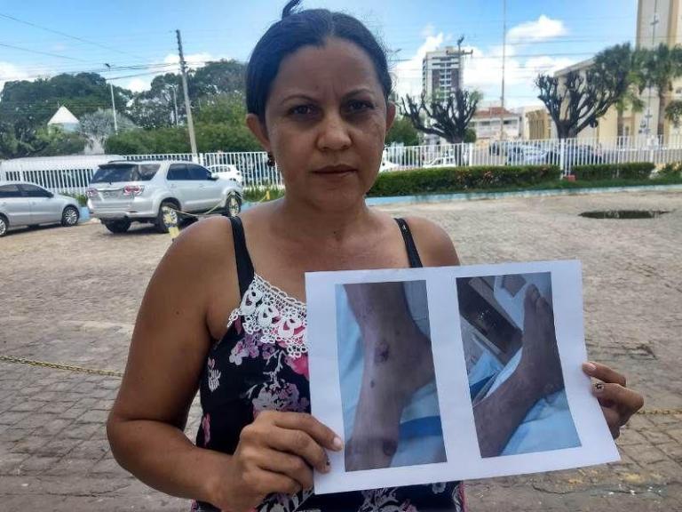 Esposa faz apelo para que marido passe por cirurgia no Complexo Hospitalar em Patos