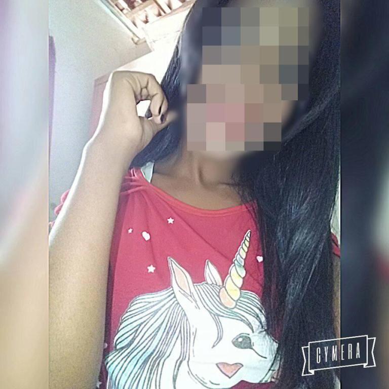 Vítima que teve a perna amputada após acidente está internada na UTI do Hospital regional de Patos