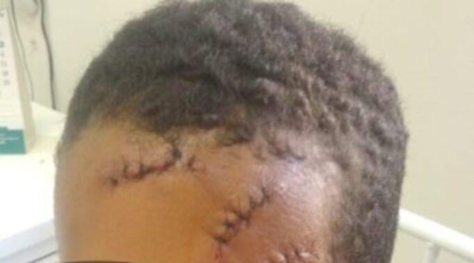 Idoso suspeito de agredir criança com foice é preso, em Piancó